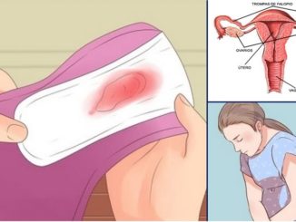 cáncer de cuello uterino