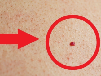 punto rojo en la piel